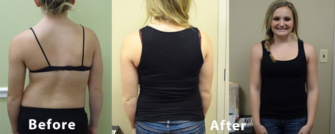 beforeafter-gymgirl