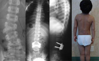 congenital-case1