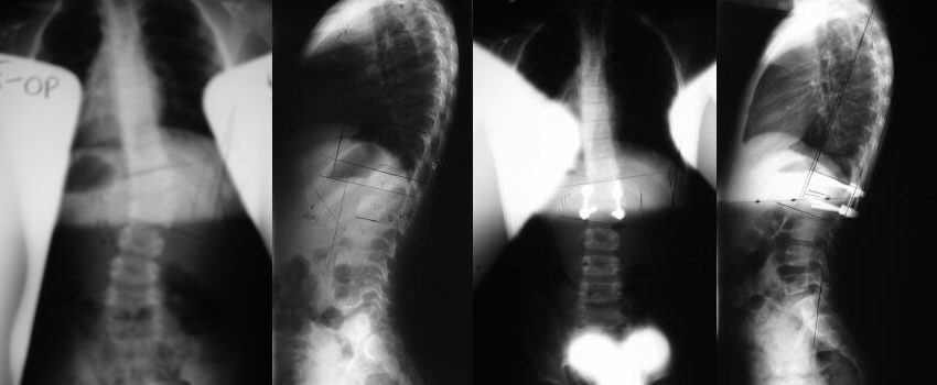 congenital-case3b