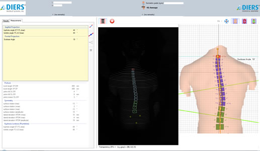 diers_scan_results2