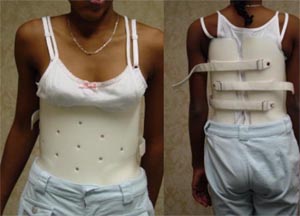 our_bracecaption2