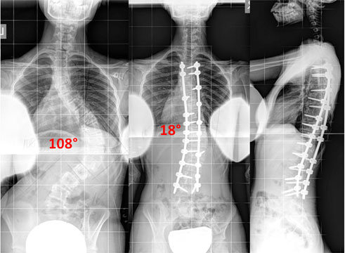 preop-xray