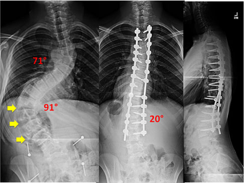 unique-patient-xray