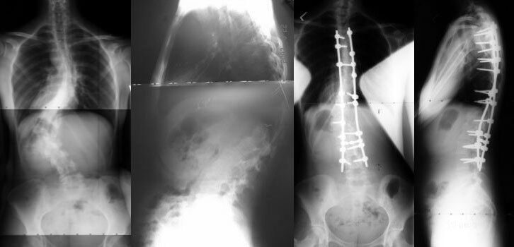 vertebralcase1 vertebralcase1