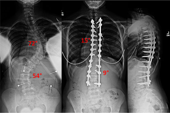 xray-double-curve