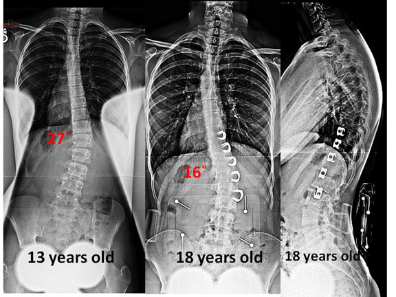 years-spinal-xray
