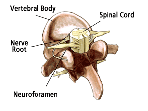 Lumbar Spinal Stenosis (Narrow Canal), Adult Spinal Disorders, Adults