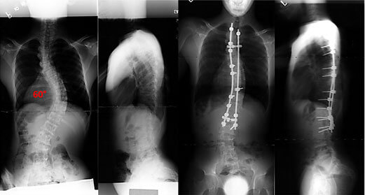 dysplasias-story-xray