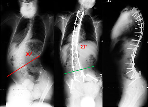 neuromuscular-story1-photo