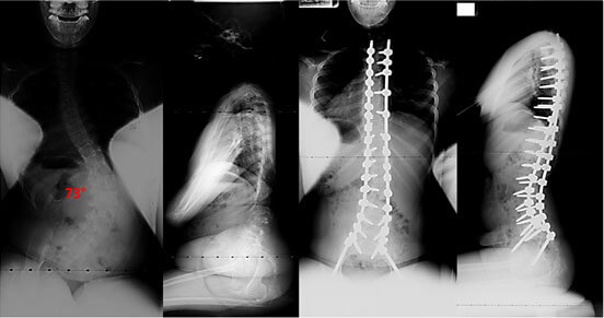 neuromuscular-story2-photo neuromuscular-story2-photo