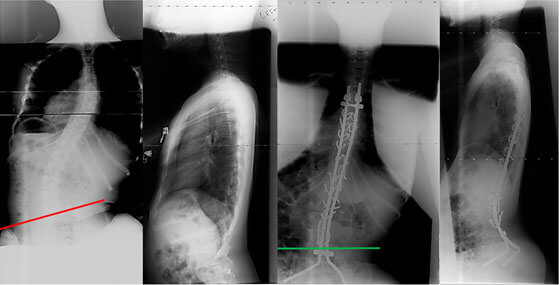 neuromuscular-story3-photo